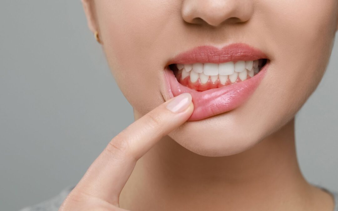 Healthy Gums