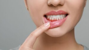 healthy gums